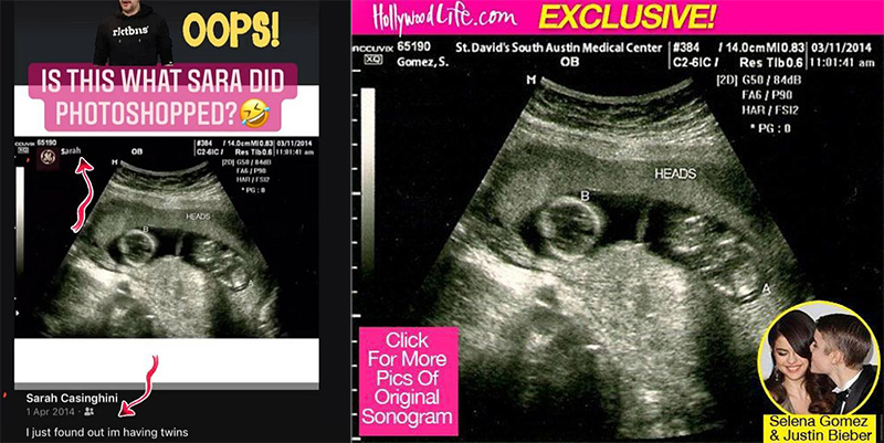 อัลตราซาวด์ปลอม ซาร่า คาซิงกินี