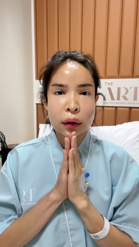 นัท นิสามณี หน้าบวมจนจำไม่ได้