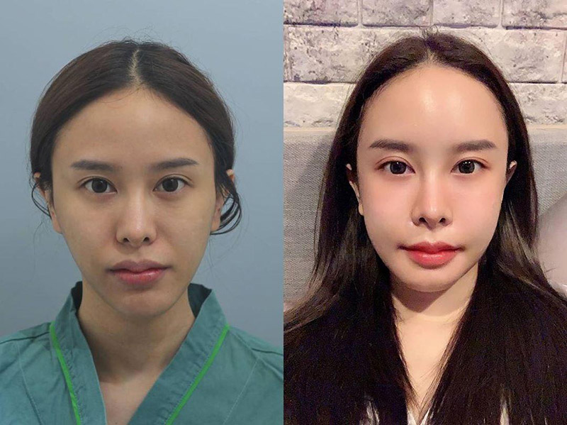 ดาราศัลยกรรม