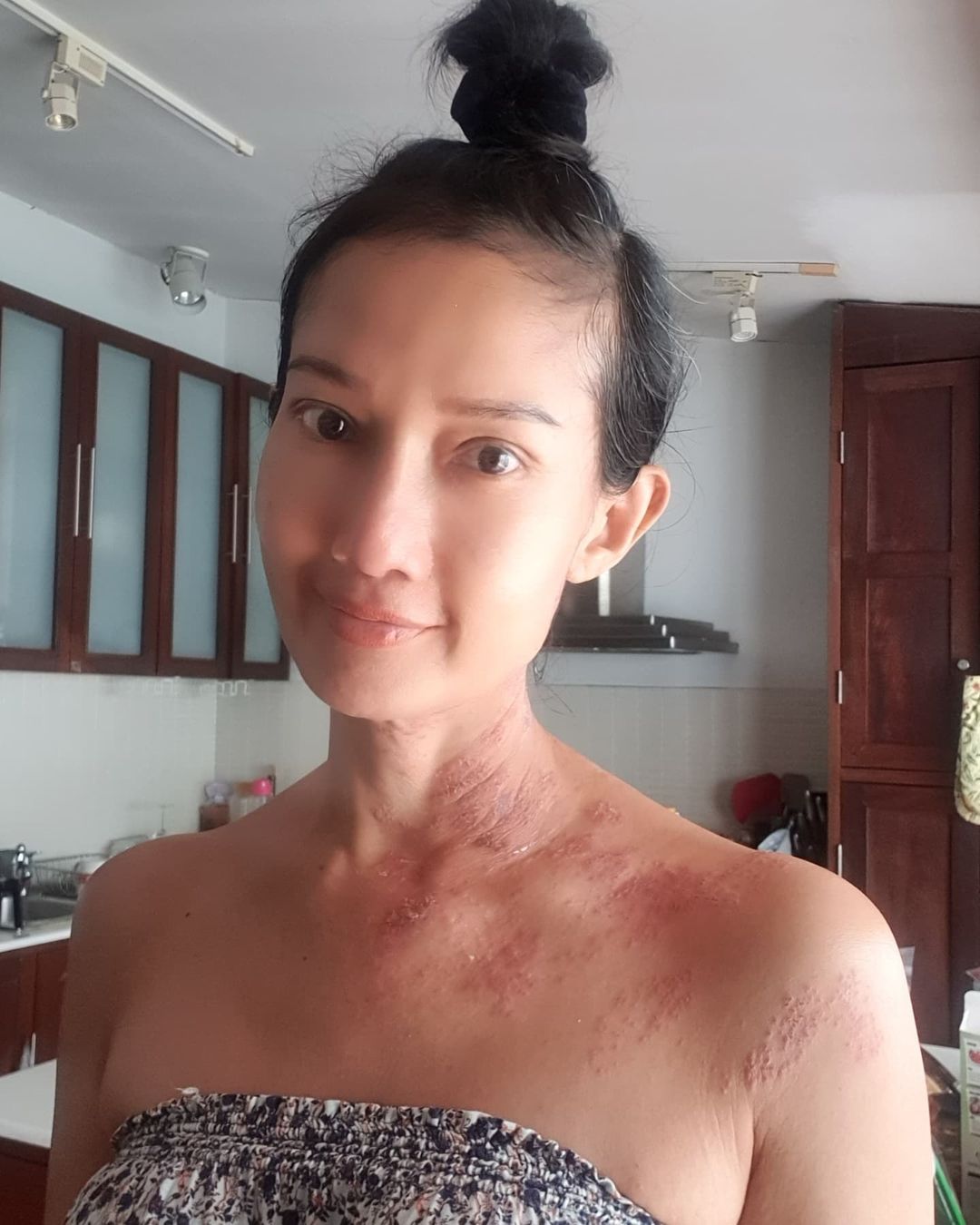 ดี้ ชนานา