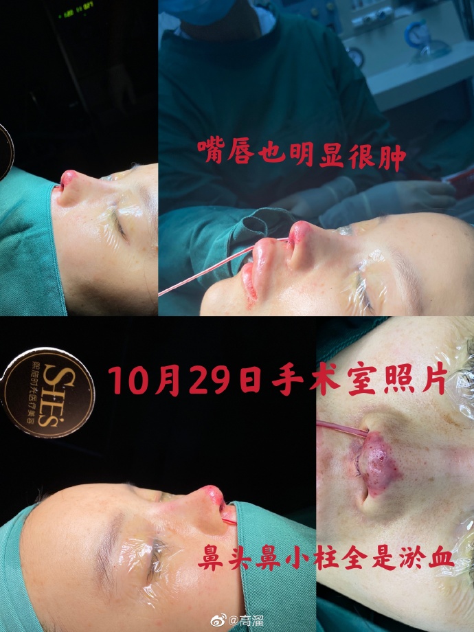 เกา หลิว (Gao Liu)