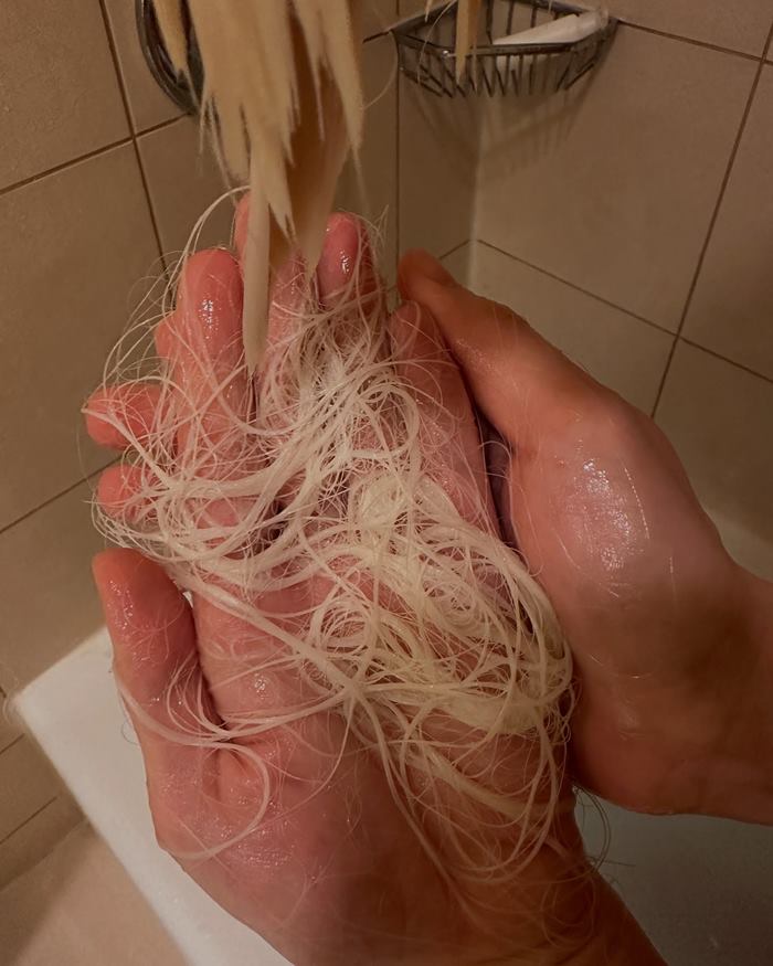 ดีเจโซดา ผมร่วง