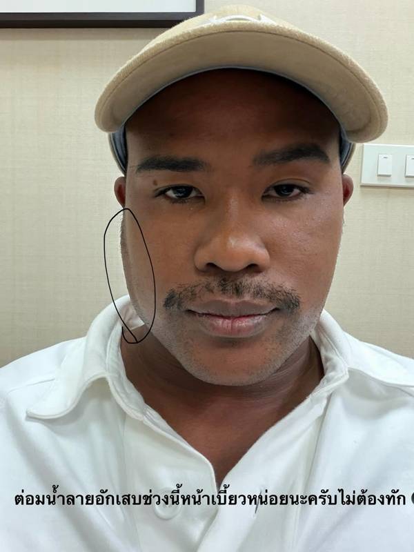 รัศมีแข เผยภาพหน้าเบี้ยว