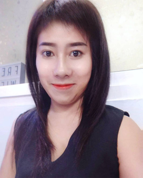 หนูรัตน์ ศัลยกรรม