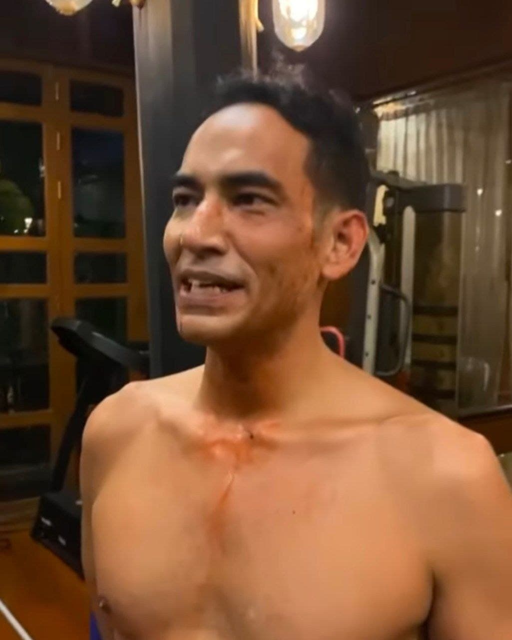 ซิกแพค