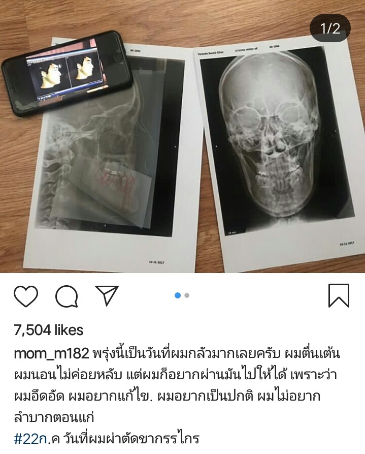 หม่อมเอ็ม