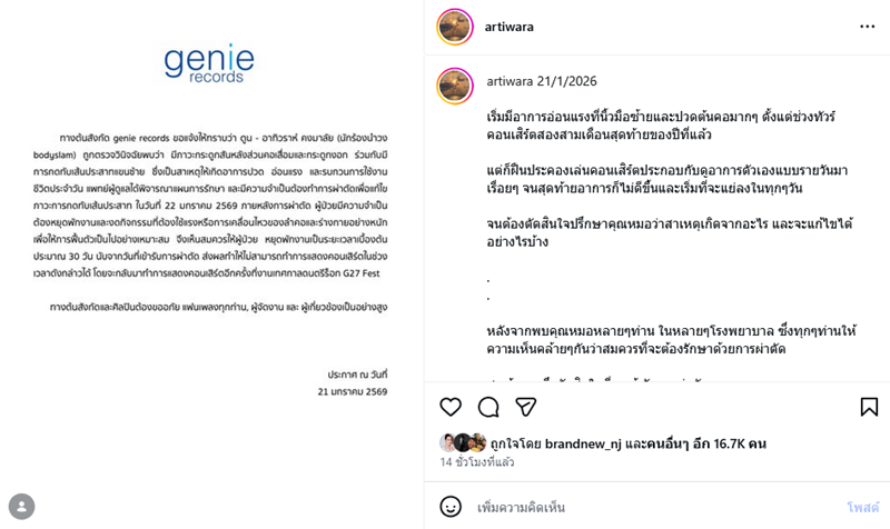 ตูน บอดี้สแลม เข้าผ่าตัดกระดูกคอกดทับเส้นประสาท