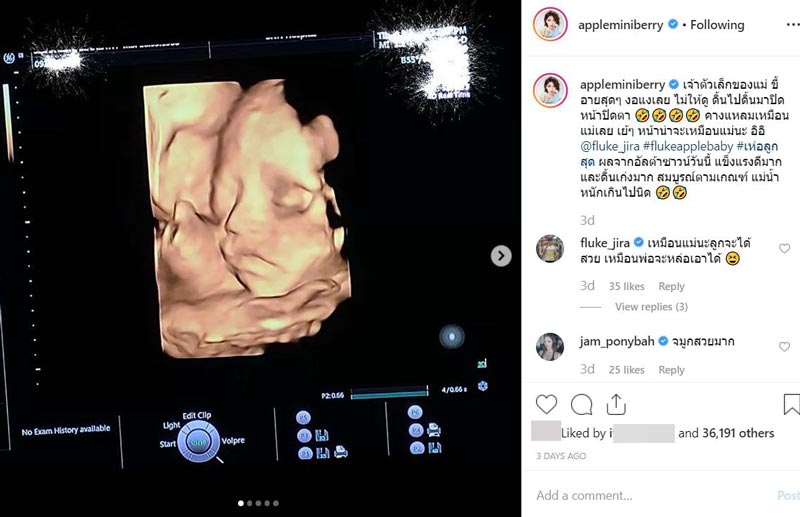 ฟลุค แอปเปิ้ล