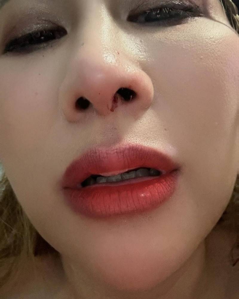 ลาล่า อาร์สยาม, ฝุ่น PM2.5