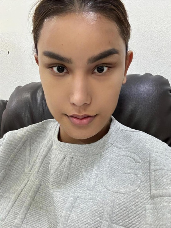 เพจดังชี้ แอนนา ทีวีพูล ทำร้ายตัวเอง