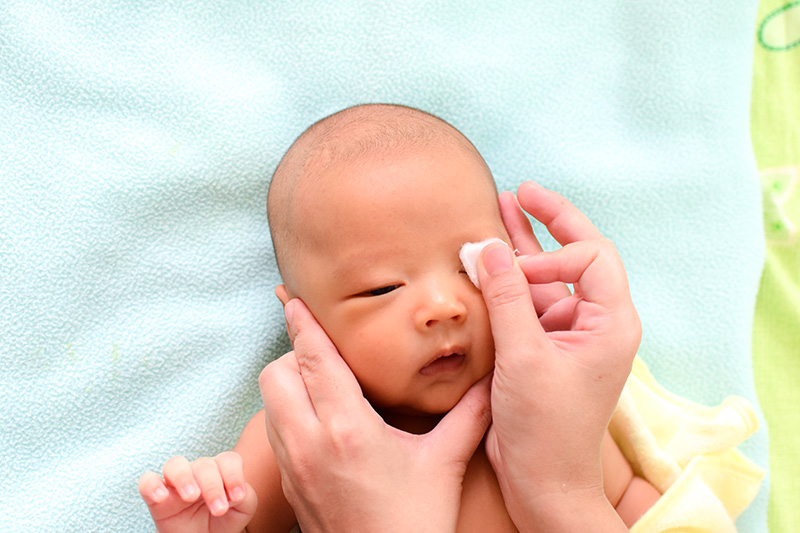 วิธีดูแลทารกตาแฉะ ขี้ตาเยอะ ต้องทำอย่างไรให้ลูกน้อยหายเร็วขึ้น