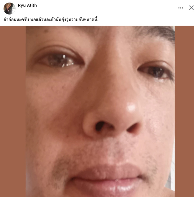 ริว อาทิตย์