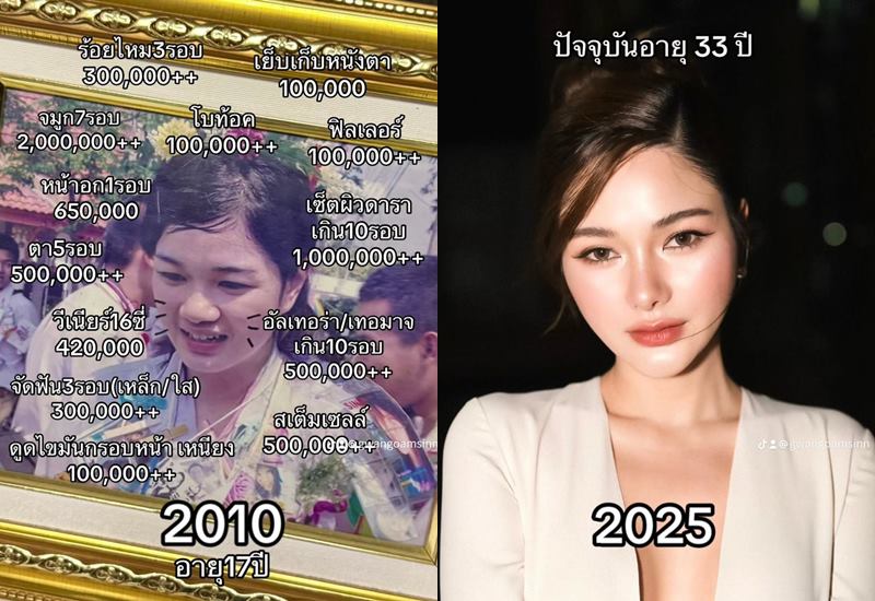 กวาง วรรณปิยะ ศัลยกรรม