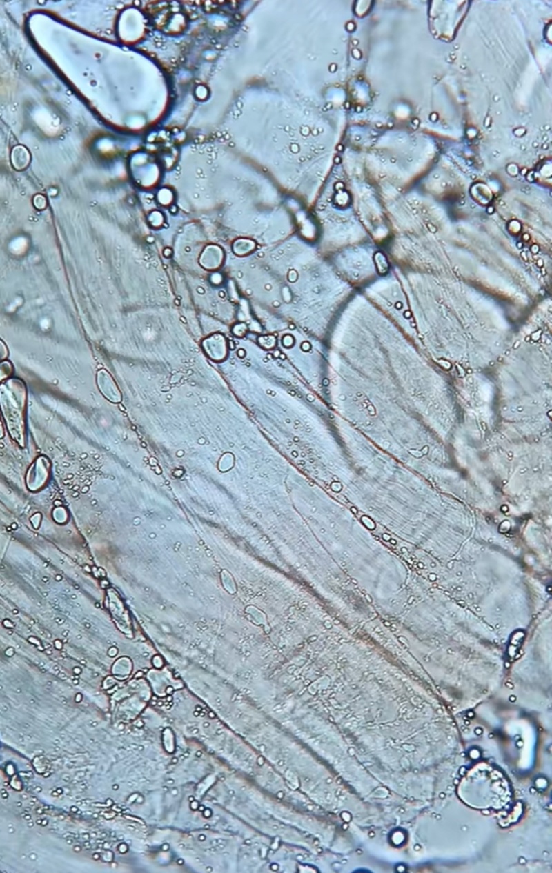 แซลมอนดอง