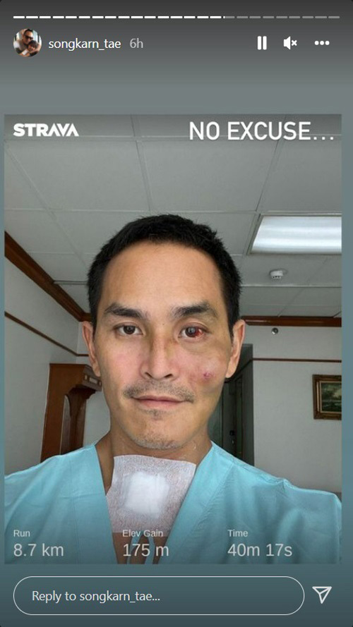 สงกรานต์ เตชะณรงค์