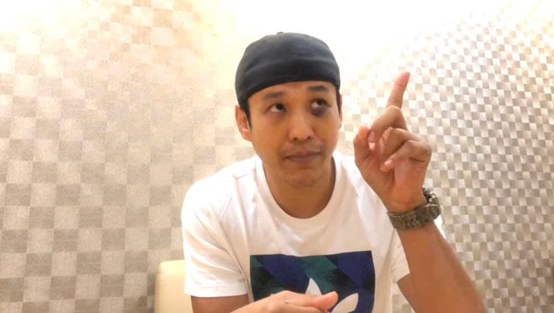 เอ็กซ์ ธิตินันท์