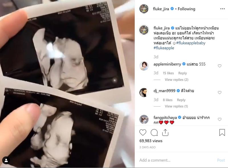 ฟลุค แอปเปิ้ล