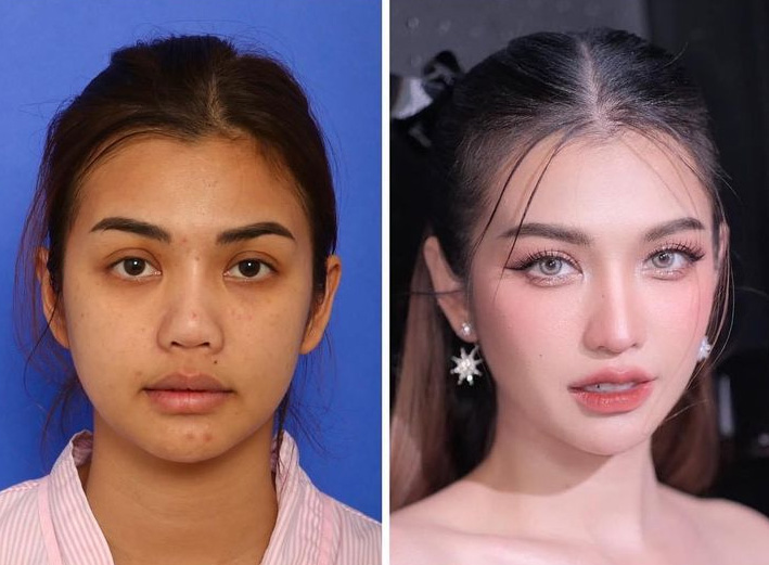 หนูเล็ก บลูเบอร์รี่