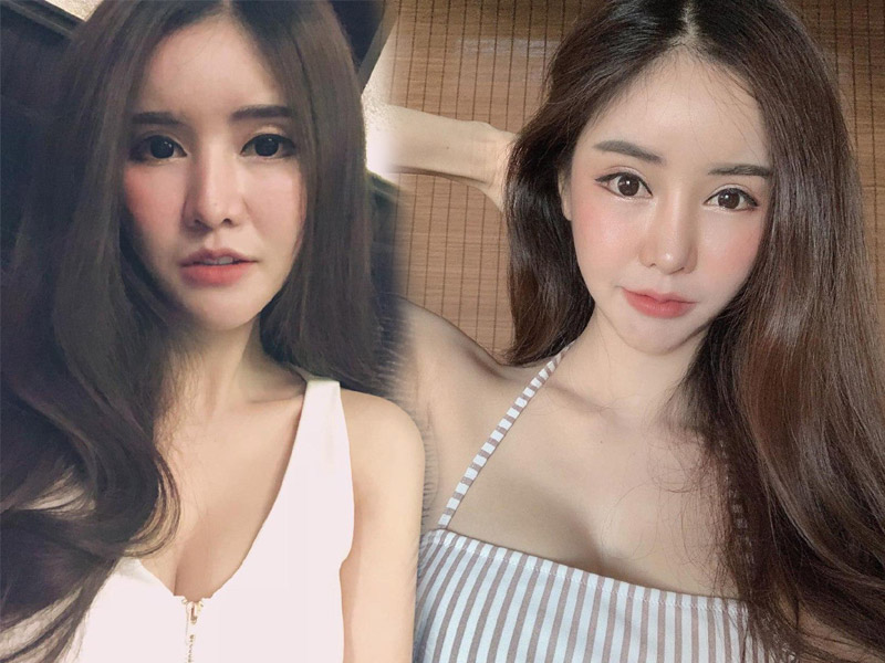 ดาราศัลยกรรม