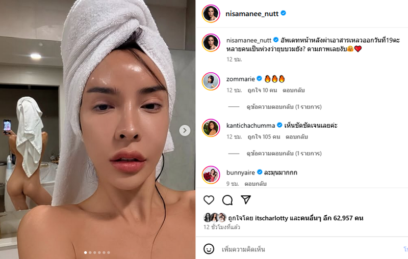 นัท นิสามณี เปิดหน้าล่าสุดหลังผ่าตัด