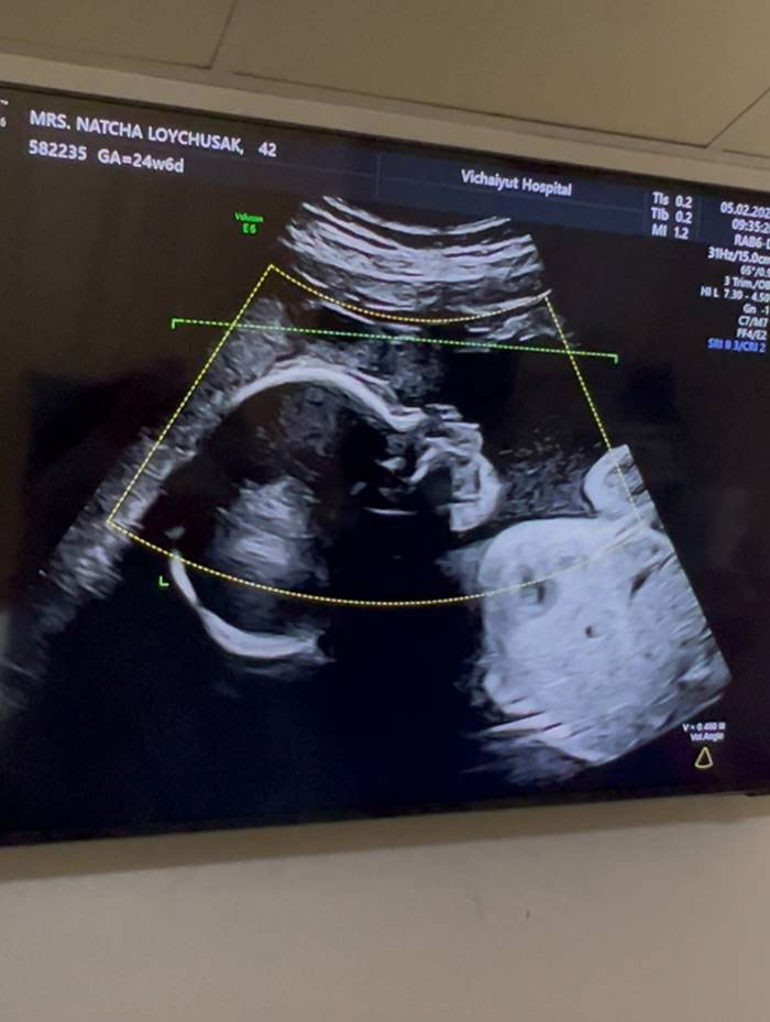  เจมส์ เรืองศักดิ์