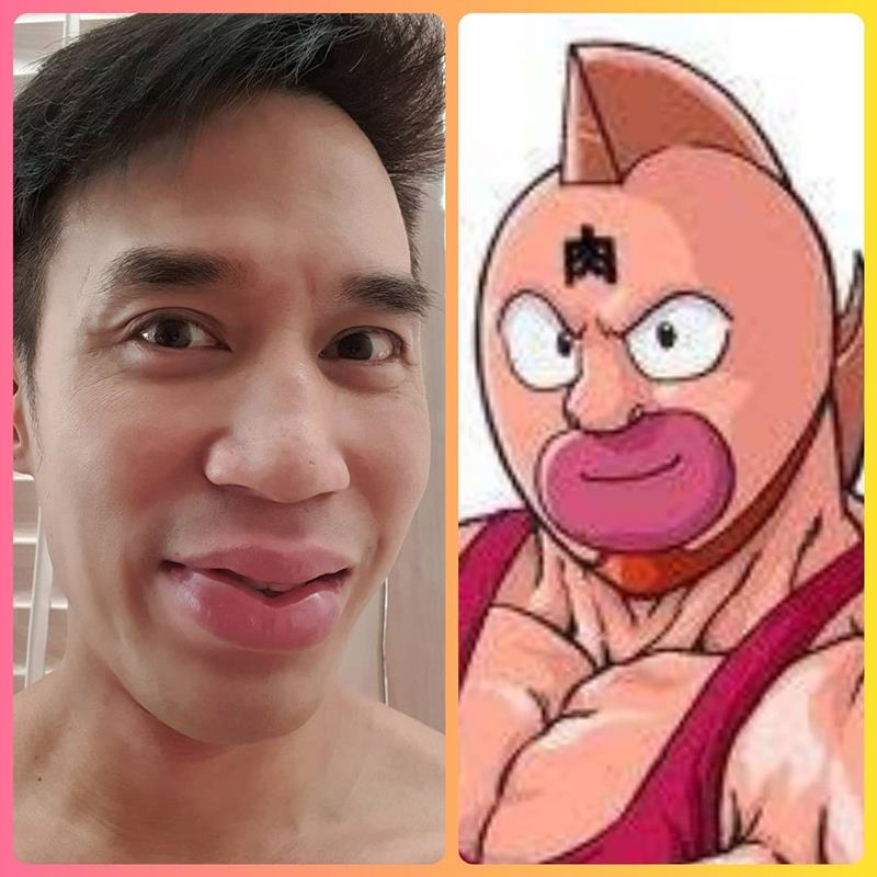 ดอม เหตระกูล ปากบวม