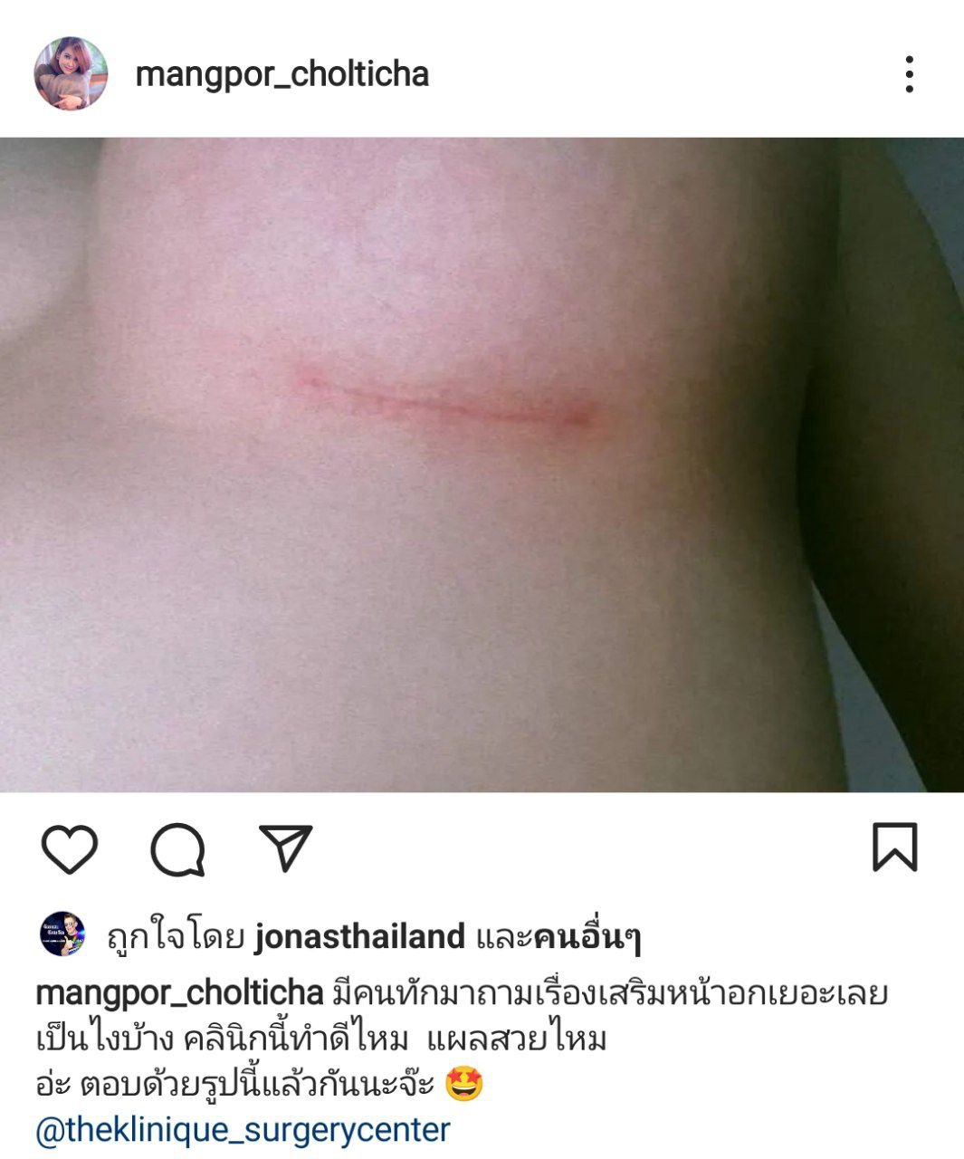   แมงปอ ชลธิชา 