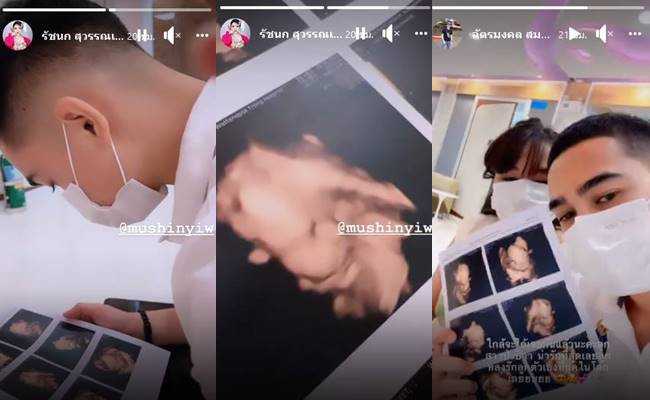 เจนนี่ ยิว  เผยภาพอัลตราซาวด์ลูกสาว