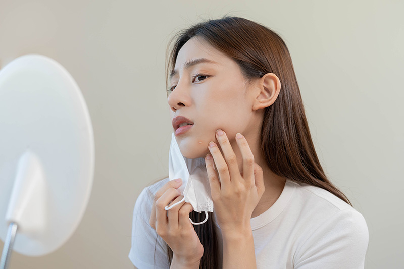 หน้าเป็นผื่นคัน ใช้ครีมอะไรดี ช่วยกู้หน้าพังให้สวยใสอีกครั้ง