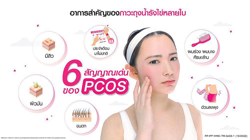 ภาวะ PCOS