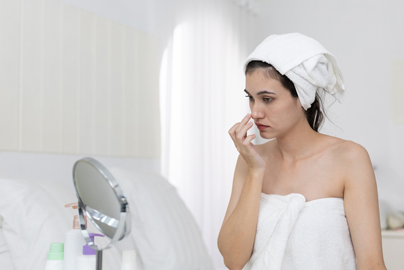 รอยแดงรอบปีกจมูก