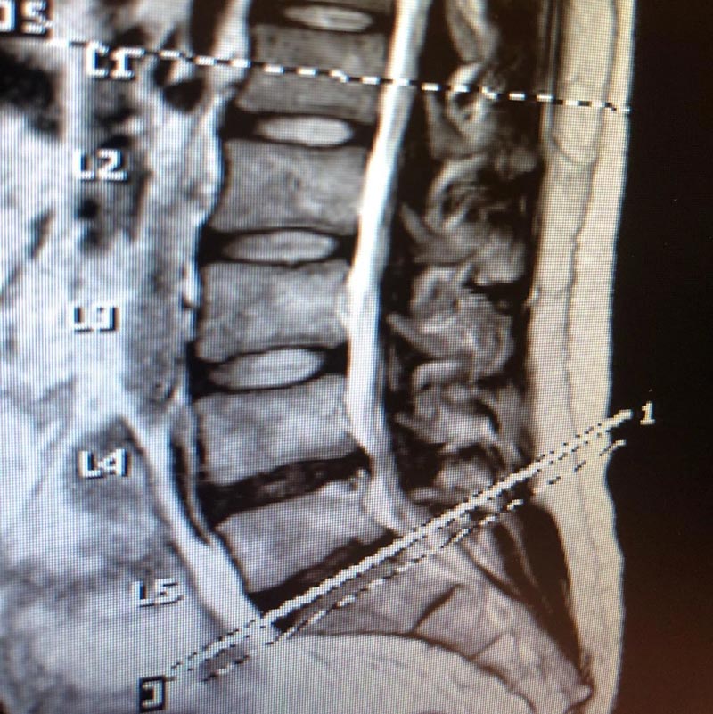 พิชญ์ กาไชย