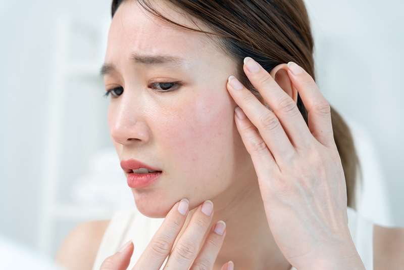 ผิวแพ้ง่าย