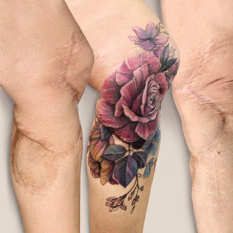 รอยสักจากรอยแผลเป็น