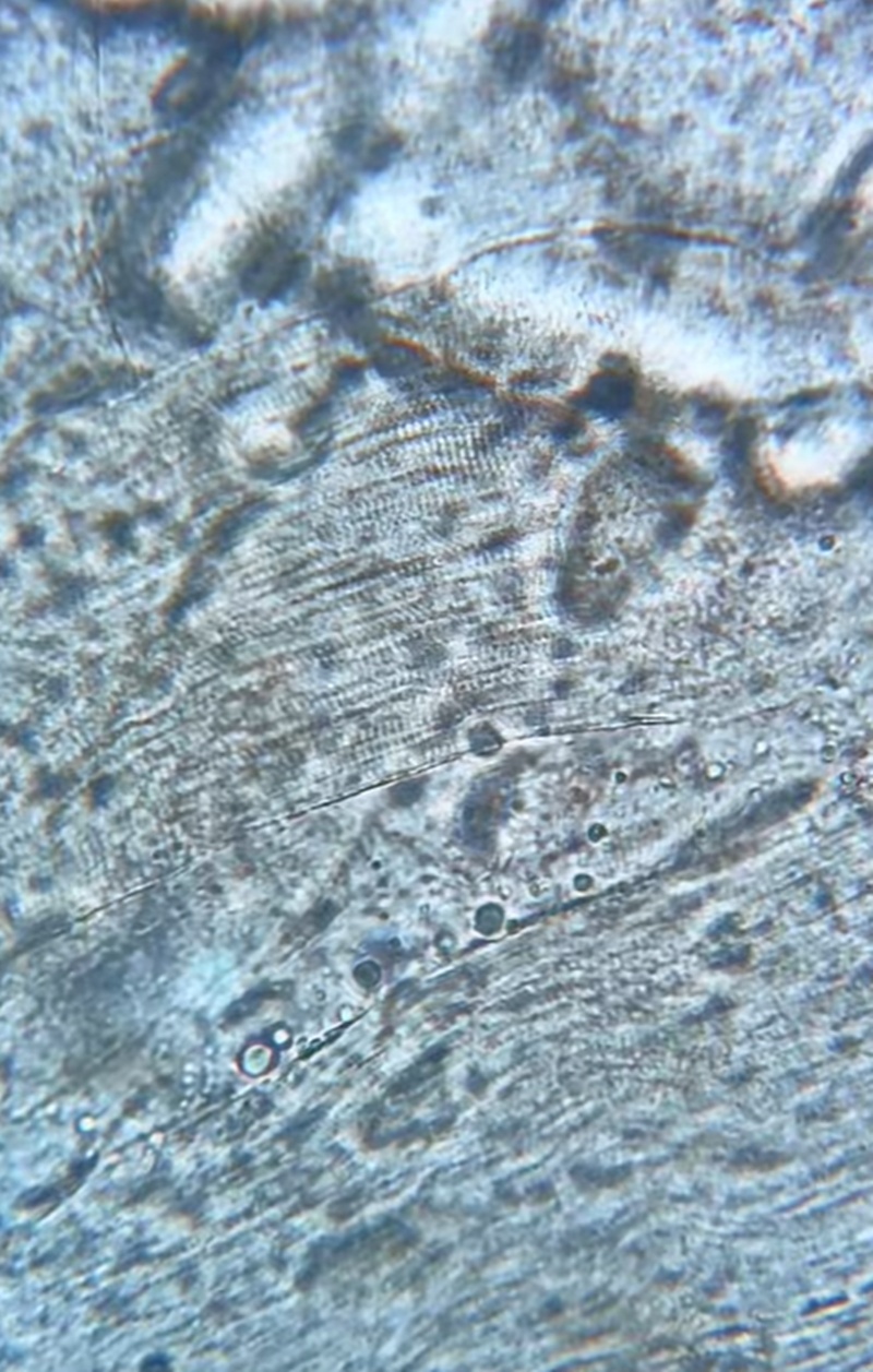 แซลมอนดอง