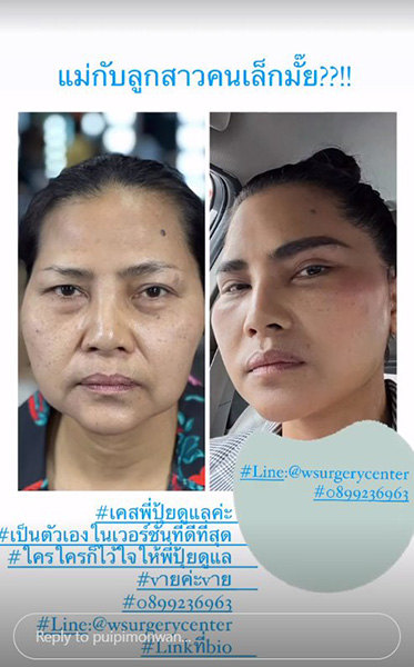 สุนารี ราชสีมา