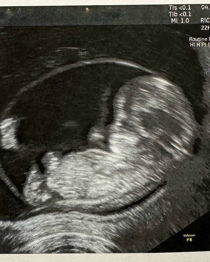 ลูก รถเมล์ คะนึงนิจ