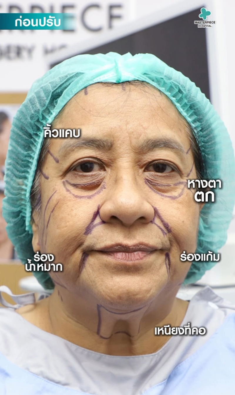 แม่บอย ภิษณุ