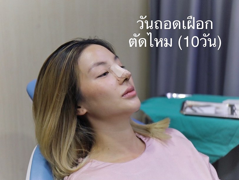 ฮารุ สุประกอบ