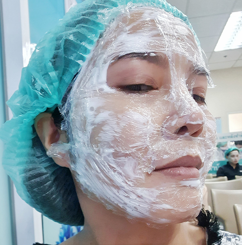 รักษาฝ้าลึก กระ จุดด่างดำ รีวิวสูตรรักษาฝ้าเร่งด่วน