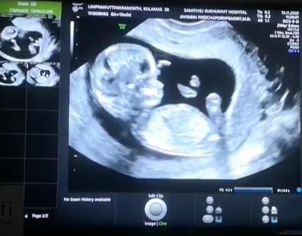 ขนมจีน กุลมาศ