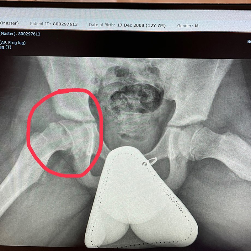 น้องโรเตอร์ ลูกพีท ทองเจือ