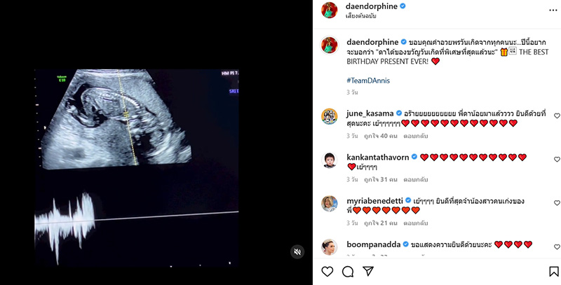 ดา เอ็นโดรฟิน ท้อง