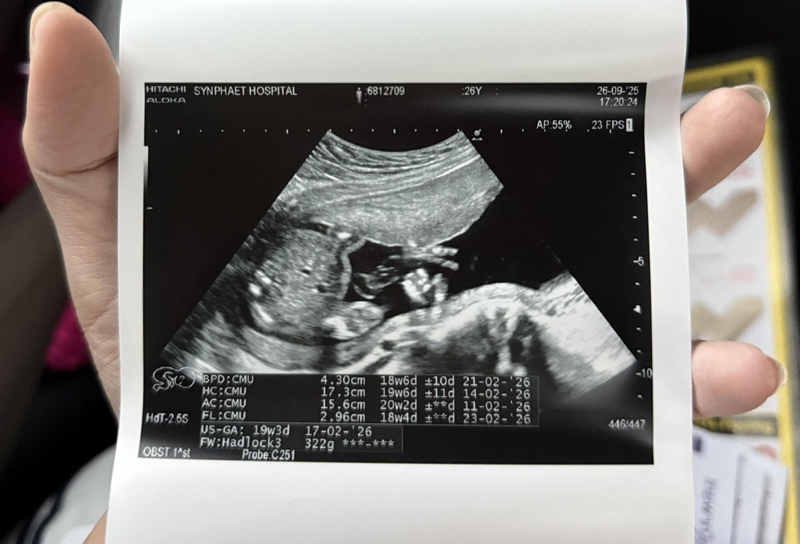 ครูเบียร์ นุติญา อุ้มท้องเข้า รพ.