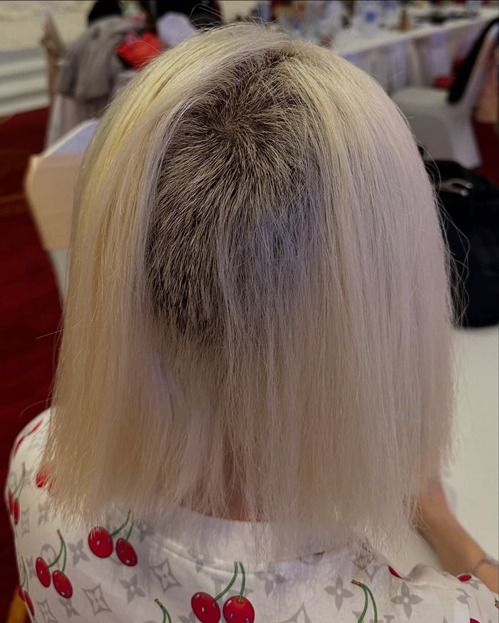 ดีเจโซดา ผมแหว่ง