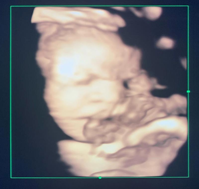 กุ๊บกิ๊บ สุมณทิพย์