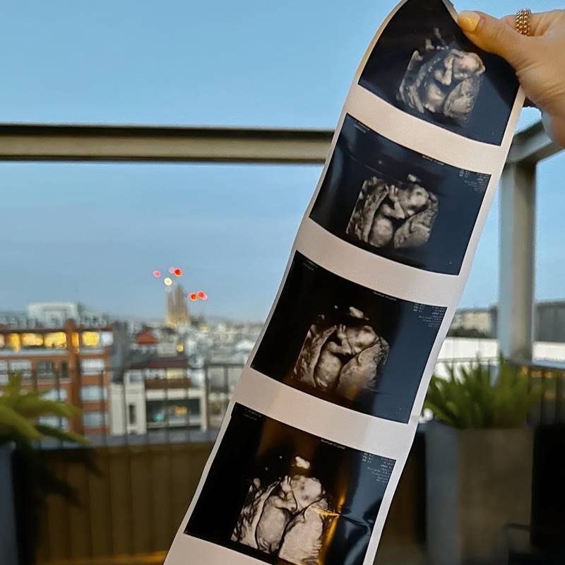 แอร์ ภัณฑิลา ท้อง