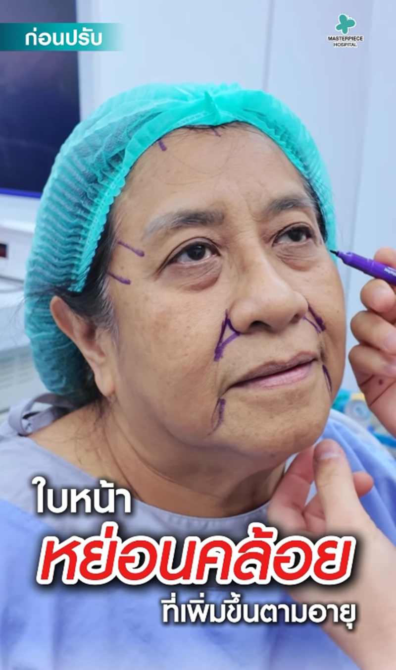 แม่บอย ภิษณุ