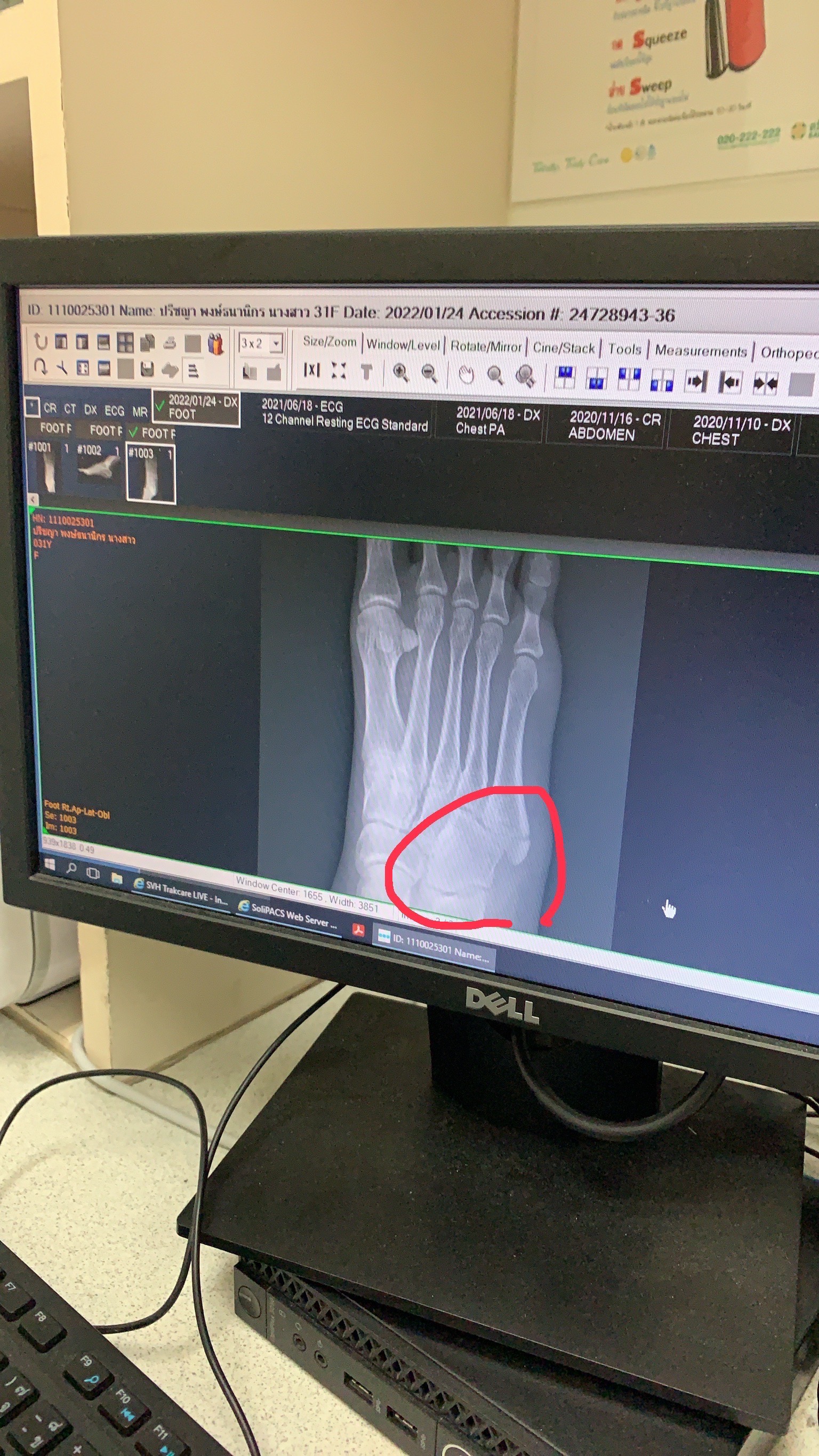 ไอซ์ ปรีชญา