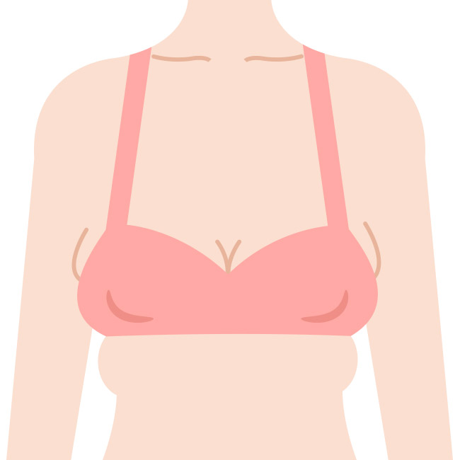 หน้าอกหย่อนคล้อย